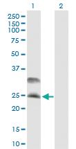 Anti-DNAJC5 Mouse Polyclonal Antibody