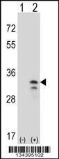 Anti-OSM Rabbit Polyclonal Antibody (APC (Allophycocyanin))