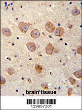 Anti-SKOR2 Rabbit Polyclonal Antibody (FITC (Fluorescein Isothiocyanate))