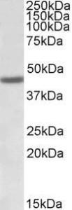 Anti-FANCL Antibody (A83008) (1 µg/ml) staining of Human Bone Marrow lysate (35 µg protein in RIPA buffer) Primary incubation was 1 hour Detected by chemiluminescence