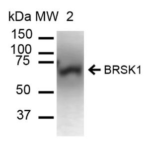 Western blot analysis of mouse brain cell lysates showing detection of ~85.1 kDa BRSK1 protein using Anti-BRSK1 Antibody (A304939) at 1:1000 for 60  minutes at room temperature