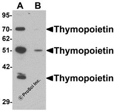 Western blot analysis of Thymopoietin in HeLa cell lysate with Thymopoietin antibody at 0.25 &#956;g/mLl in (A) the absence and (B) the presence of blocking peptide.