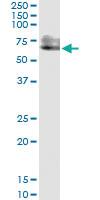 Anti-PSAP Mouse Monoclonal Antibody [clone: 3B12]