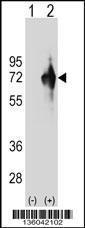 Anti-KLHDC4 Rabbit Polyclonal Antibody (APC (Allophycocyanin))