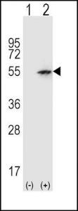 Anti-PAX6 Rabbit Polyclonal Antibody (HRP (Horseradish Peroxidase))