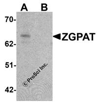 Western blot analysis of ZGPAT in SK-N-SH cell lysate with ZGPAT antibody at 1 &#956;g/mL in (A) the absence and (B) the presence of blocking peptide.