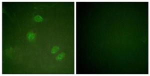 Immunofluorescence analysis of HeLa cells using Anti-Elk3 Antibody. The right hand panel represents a negative control, where the antibody was pre-incubated with the immunising peptide