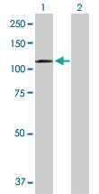 Anti-DSC2 Rabbit Polyclonal Antibody