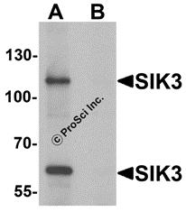 Western blot analysis of SIK3 in rat brain tissue lysate with SIK3 antibody at 1 &#956;g/mL in (A) the absence and (B) the presence of blocking peptide.