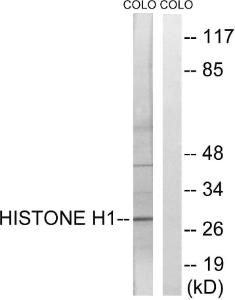 Western blot analysis of lysates from COLO cells using Anti-Histone H1 Antibody The right hand lane represents a negative control, where the antibody is blocked by the immunising peptide