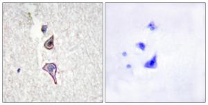 Immunohistochemical analysis of paraffin-embedded human brain tissue using Anti-MRC2 Antibody The right hand panel represents a negative control, where the antibody was pre-incubated with the immunising peptide