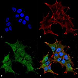 Immunocytochemistry/Immunofluorescence analysis of human neuroblastoma cell line (SK-N-BE, fixed in 4% formaldehyde for 15  min at room temperature, using Anti-BRSK1 Antibody (A304939), at 1:100 for 60  minutes at room temperature.