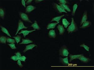 Anti-NEK9 Mouse Monoclonal Antibody [clone: 1F6]