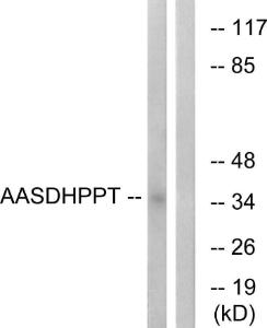 Western blot analysis of lysates from COLO cells using Anti-AASDHPPT Antibody. The right hand lane represents a negative control, where the Antibody is blocked by the immunising peptide