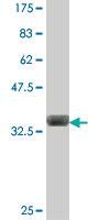 Anti-ASCC2 Mouse Polyclonal Antibody