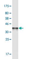 Anti-SHMT2 Mouse Monoclonal Antibody [clone: 5E7]