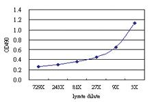 Anti-TCEB3 Antibody Pair