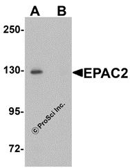 Western blot analysis of EPAC2 in rat liver tissue lysate with EPAC2 antibody at 1 &#956;g/mL in (A) the absence and (B) the presence of blocking peptide.