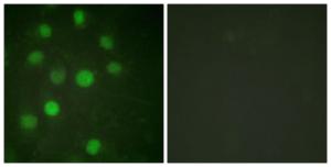 Immunofluorescence analysis of HUVEC cells using Anti-Histone H1 Antibody The right hand panel represents a negative control, where the antibody was pre-incubated with the immunising peptide