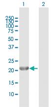 Anti-GINS1 Rabbit Polyclonal Antibody