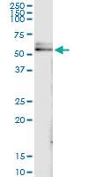 Anti-DLST Polyclonal Antibody Pair