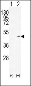 Anti-ADH1C Rabbit Polyclonal Antibody (AP (Alkaline Phosphatase))