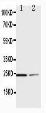 Anti-SOCS1 Rabbit Polyclonal Antibody