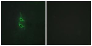 Immunofluorescence analysis of HepG2 cells using Anti-MRC2 Antibody The right hand panel represents a negative control, where the antibody was pre-incubated with the immunising peptide