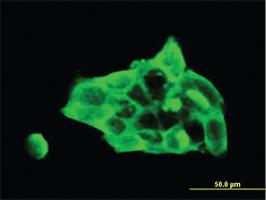 Anti-DSC3 Mouse Monoclonal Antibody [clone: 4D2]