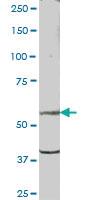 Anti-PSD Mouse Polyclonal Antibody