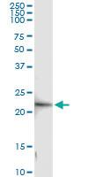 Anti-GINS1 Rabbit Polyclonal Antibody