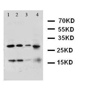 Anti-Interferon gamma Rabbit Polyclonal Antibody