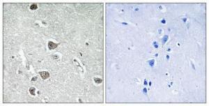 Immunohistochemical analysis of paraffin-embedded human brain using Anti-AASDHPPT Antibody 1:100 (4 °C overnight). The right hand panel represents a negative control, where the Antibody was pre-incubated with the immunising peptide