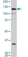 Anti-ABL2 Mouse Monoclonal Antibody [clone: 3E4]