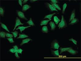 Anti-NEK9 Mouse Monoclonal Antibody [clone: 1F6]