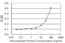 Anti-ASPA Antibody Pair