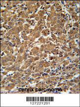 Anti-N4BP3 Rabbit Polyclonal Antibody (HRP (Horseradish Peroxidase))