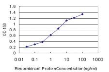 Anti-ABL2 Mouse Monoclonal Antibody [clone: 3E4]