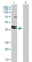 Anti-HNRNPD Rabbit Polyclonal Antibody