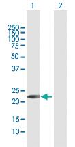 Anti-GINS1 Rabbit Polyclonal Antibody