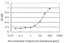 Anti-TAOK3 Mouse Monoclonal Antibody [clone: 4C12]