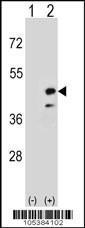 Anti-CKMT2 Rabbit Polyclonal Antibody (Biotin)