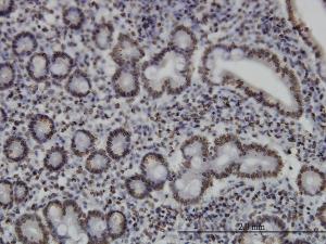 Anti-MEF2A Mouse Monoclonal Antibody [clone: 1D11]