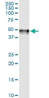 Anti-ADH7 Polyclonal Antibody Pair