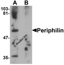 Western blot analysis of JMJD3 in K562 cell lysate with JMJD3 antibody at 0.5 &#956;g/mL in (A) the absence and (B) the presence of blocking peptide.