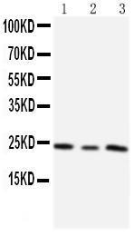 Anti-TIMP4 Rabbit Polyclonal Antibody