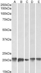 Anti-FTL Antibody (A84622) (0.1 µg/ml) staining of Human Cerebellum (A), Liver (B), Placenta (C), Mouse Brain (D) and Rat Brain (E) lysates (35 µg protein in RIPA buffer). Primary incubation was 1 hour. Detected by chemiluminescence