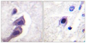 Anti-Tuberin Rabbit Polyclonal Antibody