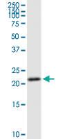 Anti-GINS1 Rabbit Polyclonal Antibody