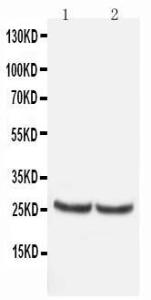 Anti-TIMP4 Rabbit Polyclonal Antibody